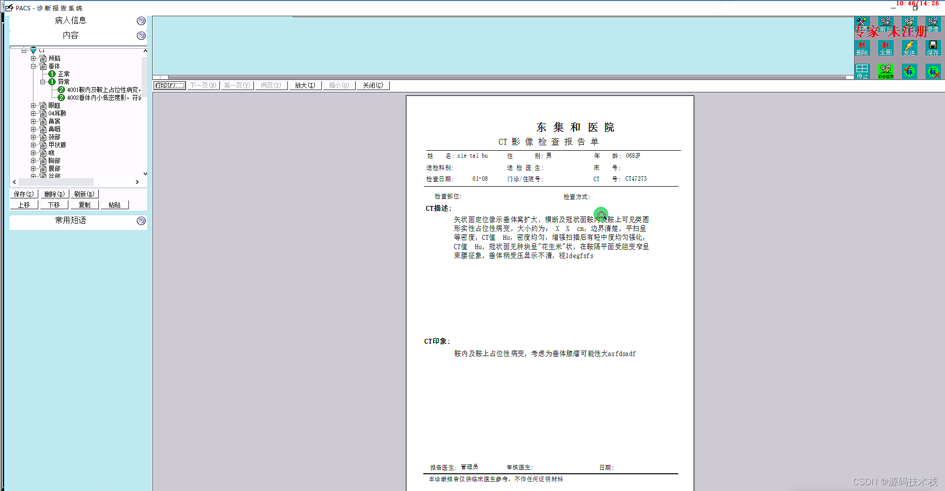 医学影像信息系统(PACS源码)基本概况和工作原理5392 作者:Struggle 帖子ID:32415 PACS源码,诊断报告