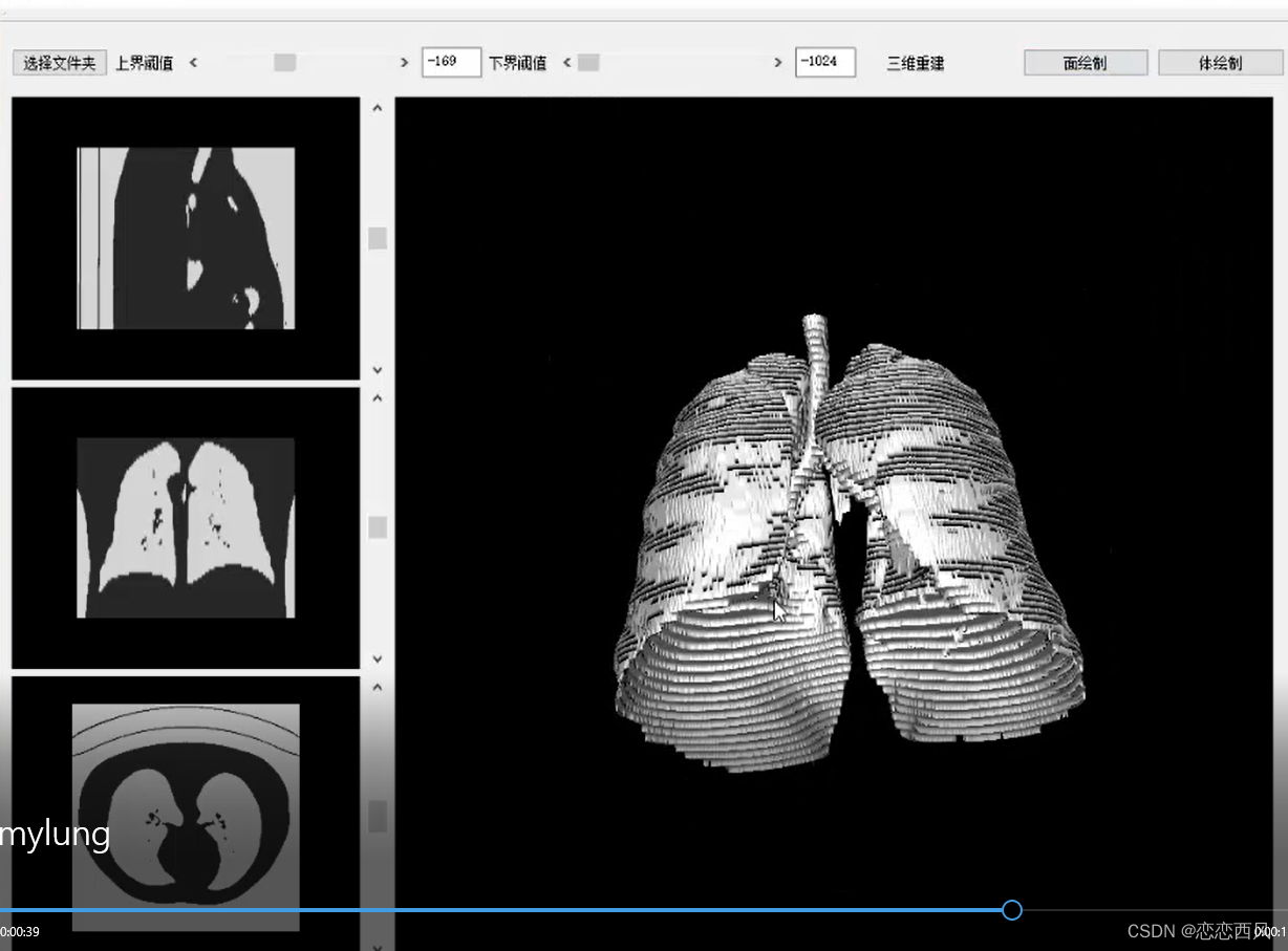 三维重建 阈值分割 3D可视化 医学图像分割 CT图像分割及重建系统 可视化编9658 作者:随风西阳 帖子ID:41803 三维重建,阈值分割,3D可视化,医学图像分割,可视化编