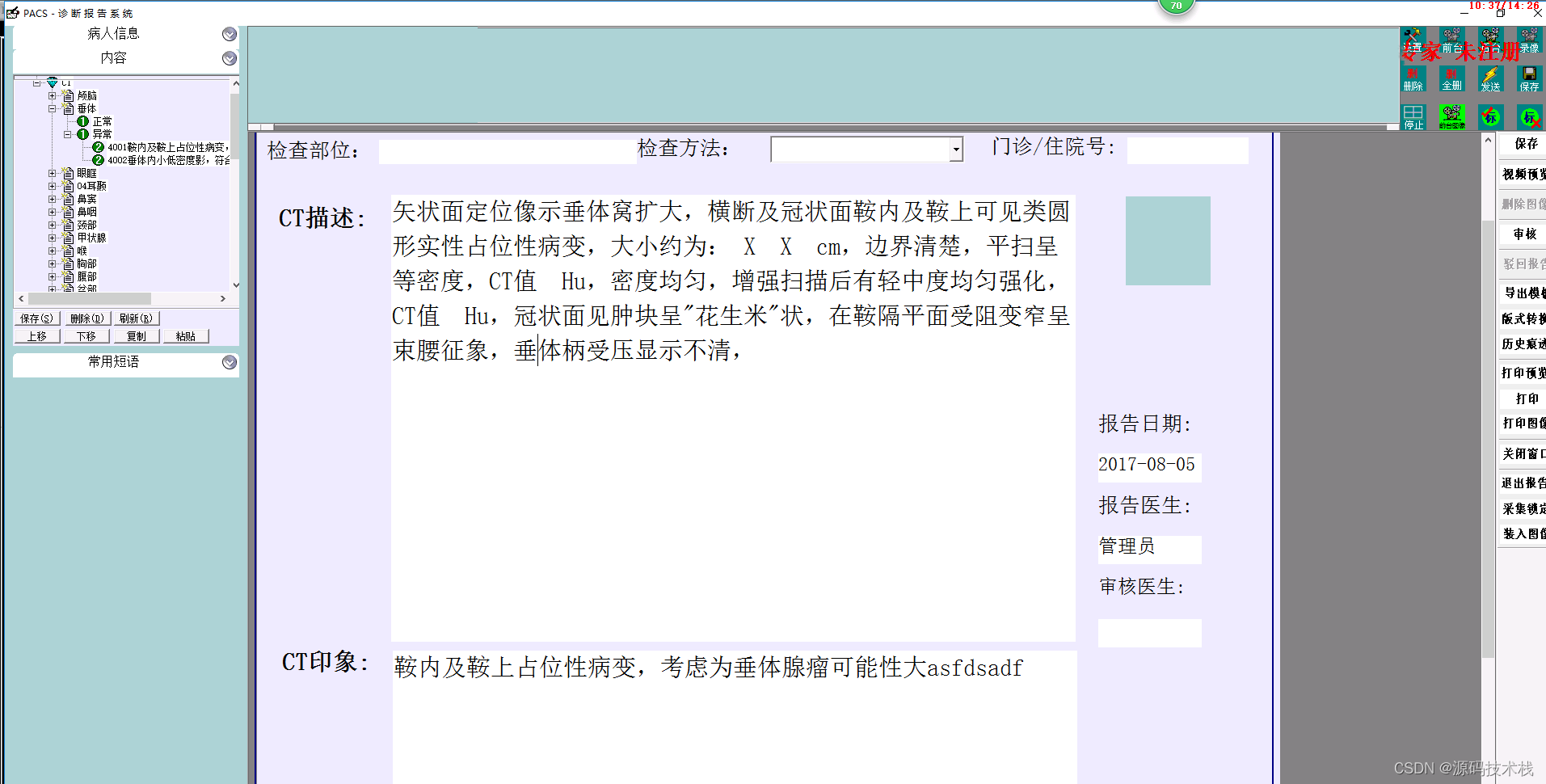 医学影像信息系统(PACS源码)基本概况和工作原理4705 作者:Struggle 帖子ID:32415 PACS源码,诊断报告