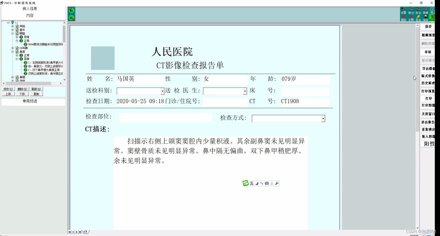 数字化存储PACS/RIS系统源码，C/S架构的PACS系统源码1945 作者:手术室老王 帖子ID:41704 