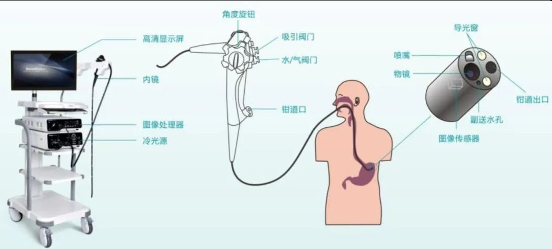 一文读懂内窥镜，找到FPGA的定位1195 作者:忠信 帖子ID:41835 