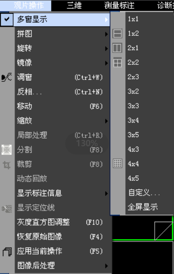 突破传统 重新定义：3D医学影像PACS系统源码（包含RIS放射信息）实现三维重2683 作者:随风西阳 帖子ID:42160 