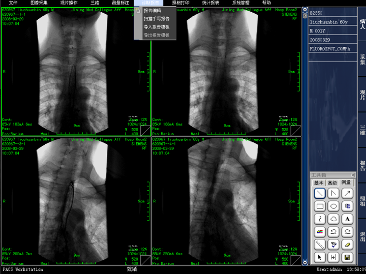 突破传统 重新定义：3D医学影像PACS系统源码（包含RIS放射信息）实现三维重717 作者:随风西阳 帖子ID:42160 
